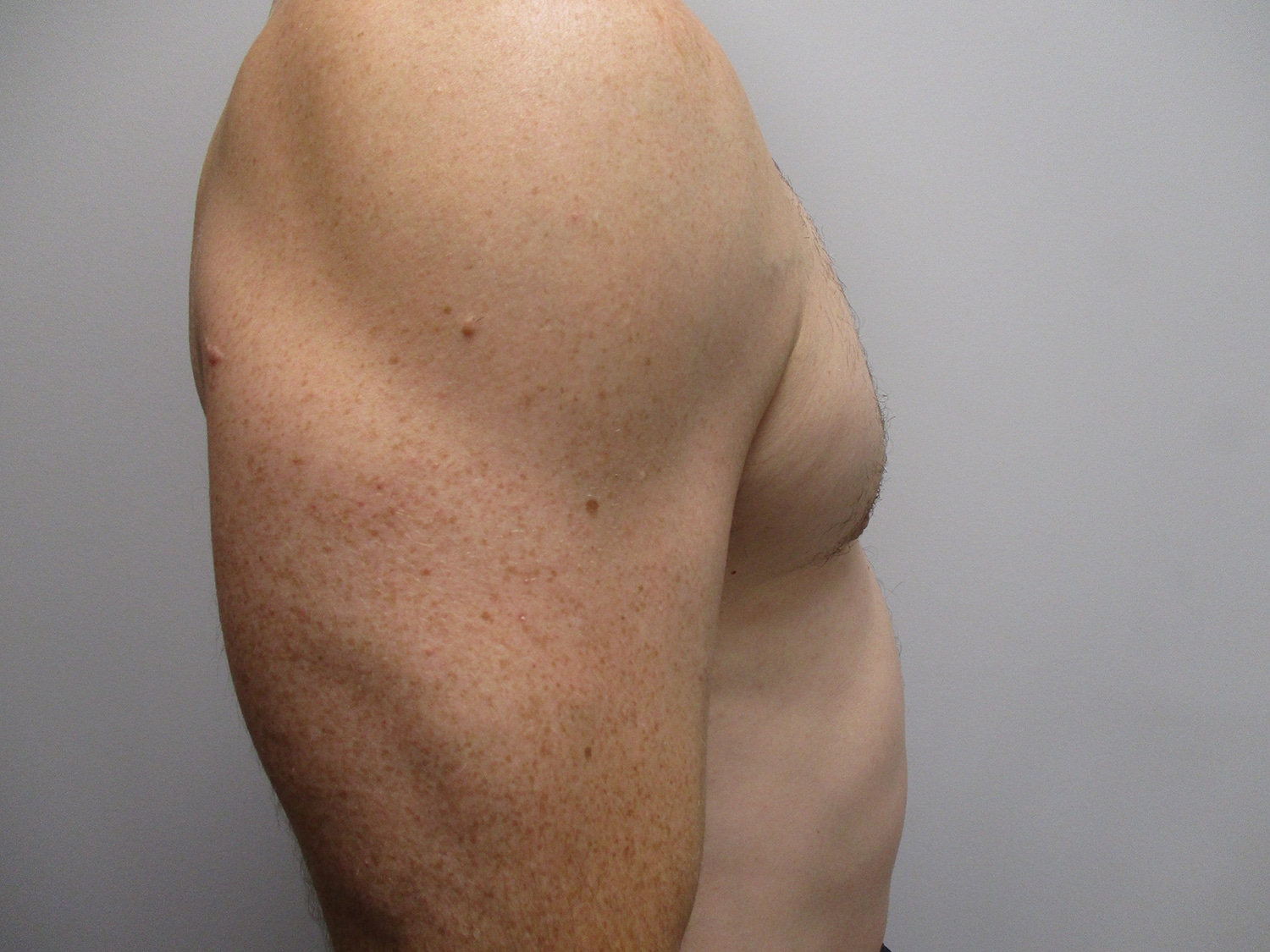 After Image: Patient 20461 - right-side
