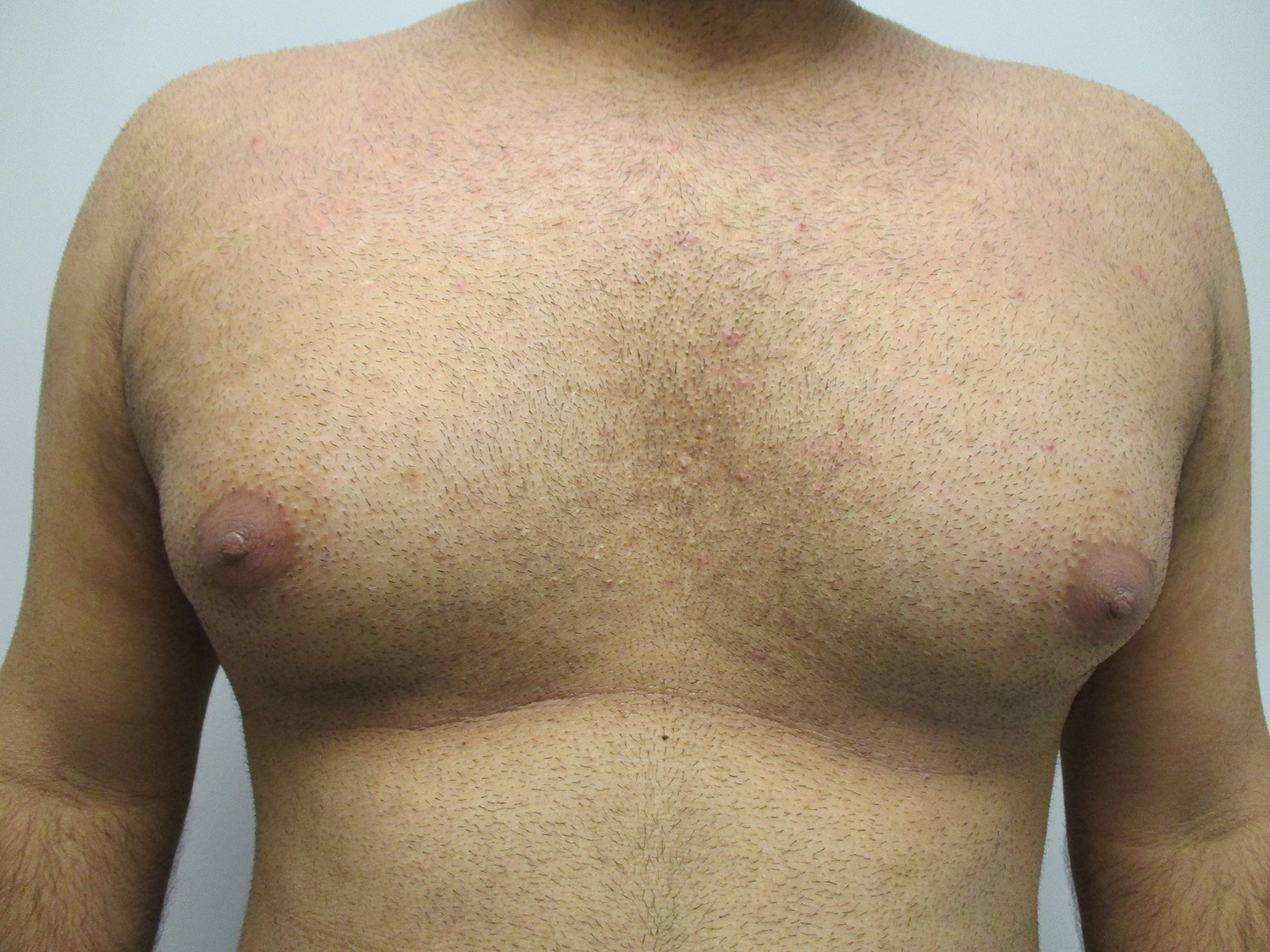 Before Image: Patient 21138 - front
