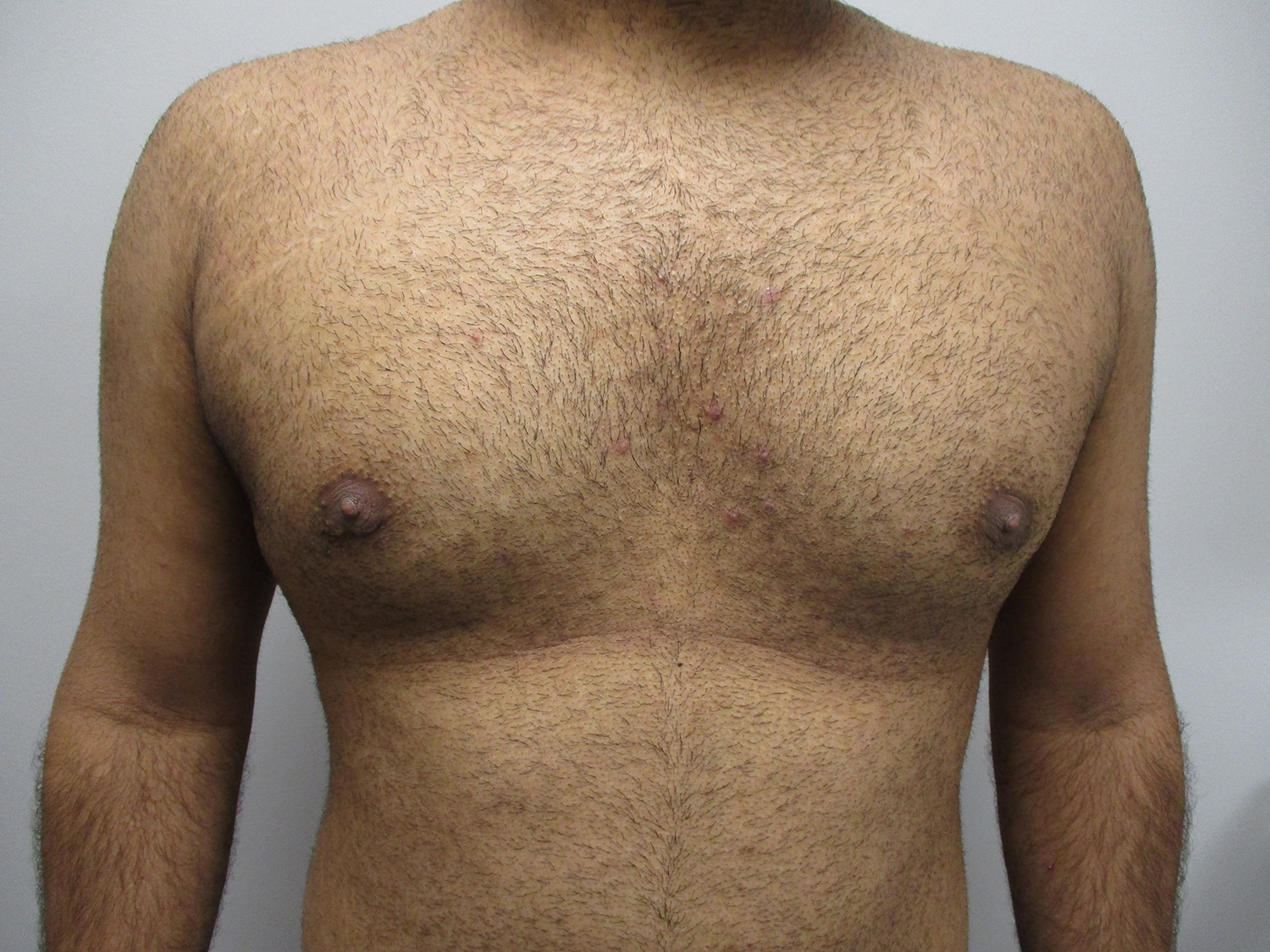 After Image: Patient 21138 - front