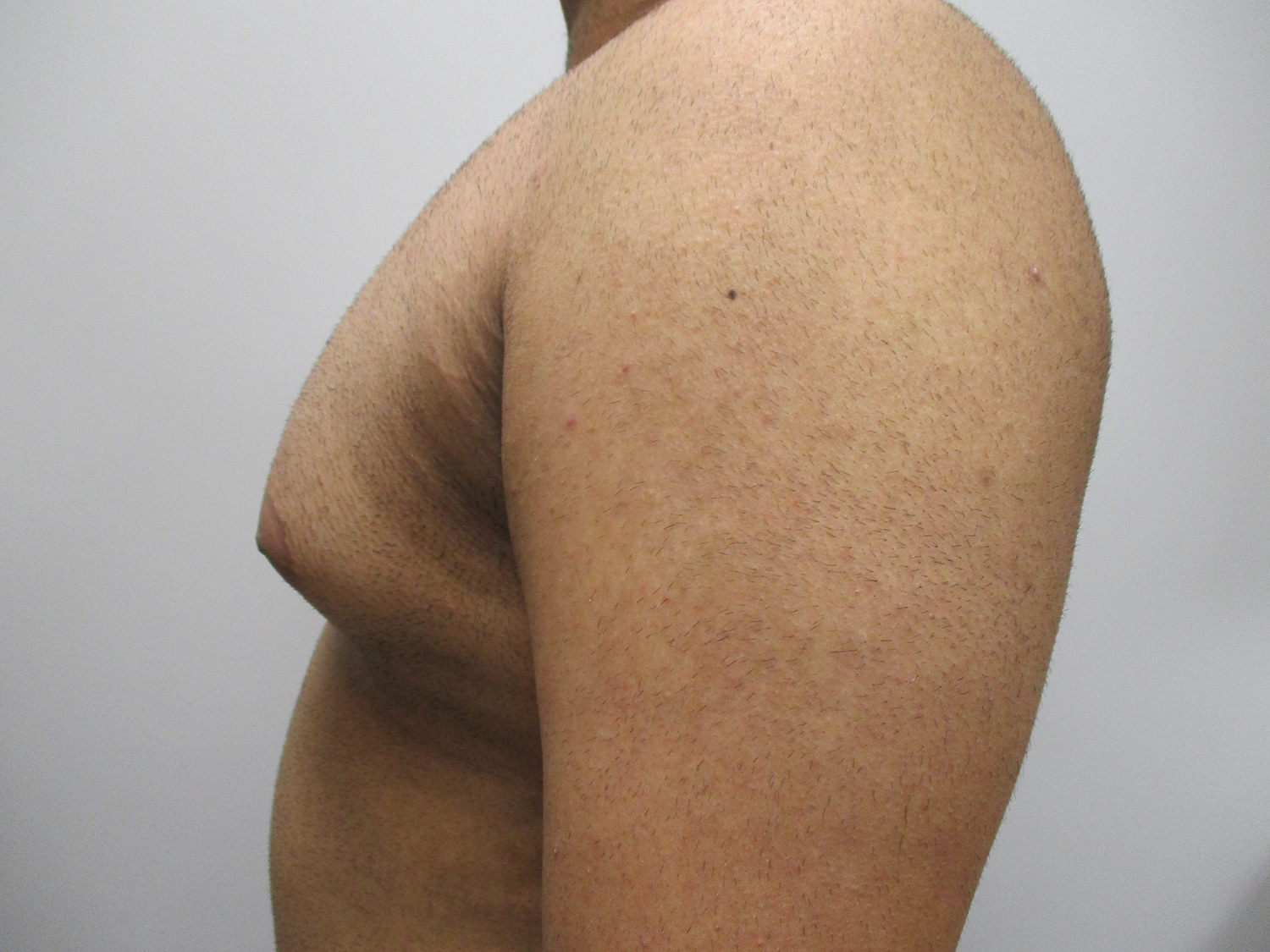 Before Image: Patient 21138 - left-side
