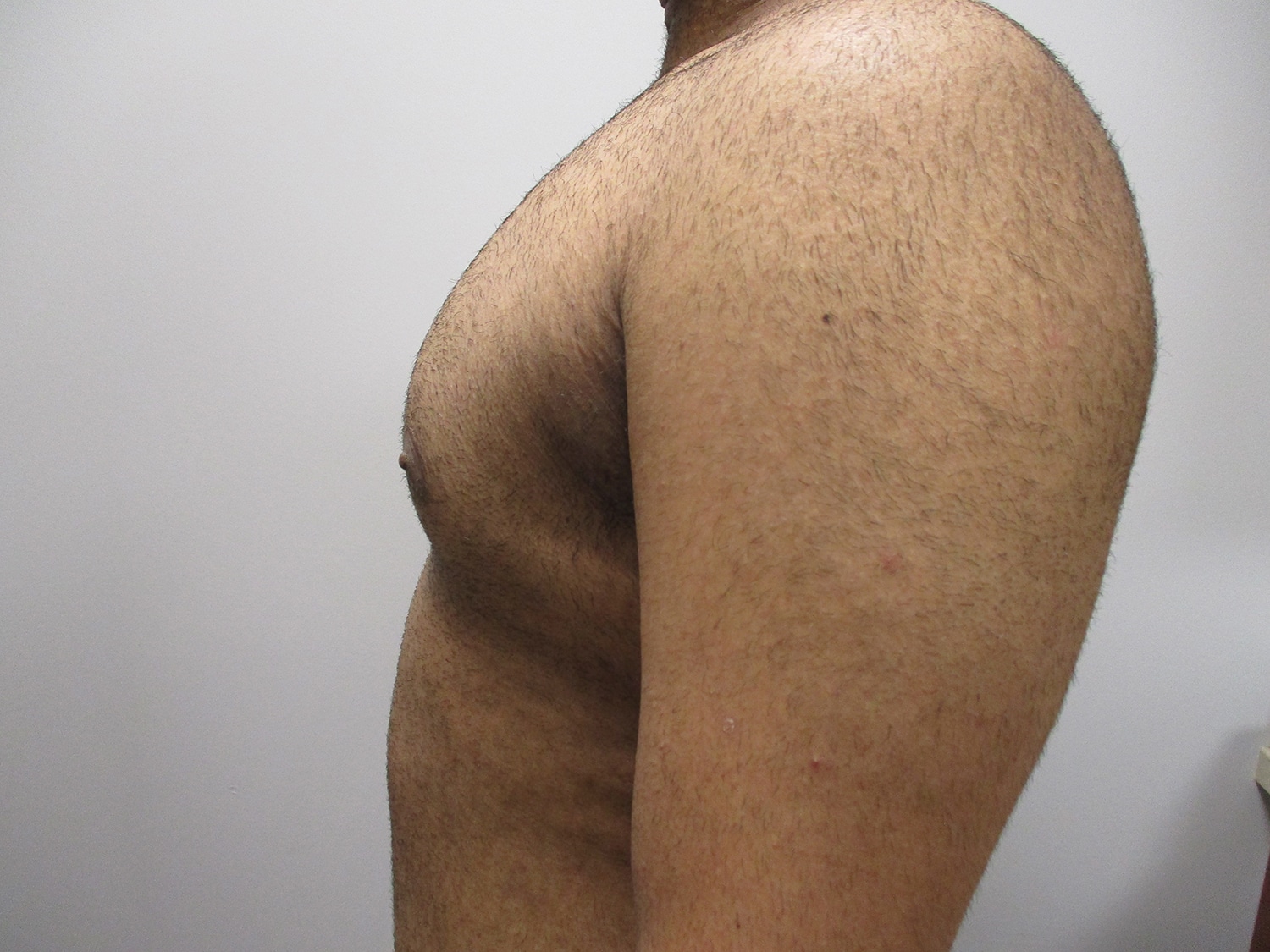 After Image: Patient 21138 - left-side