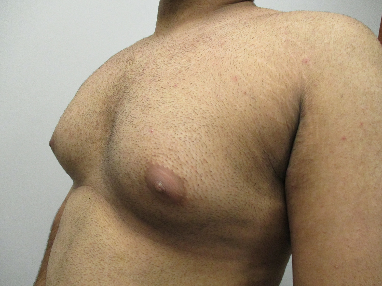 Before Image: Patient 21138 - left-front-oblique