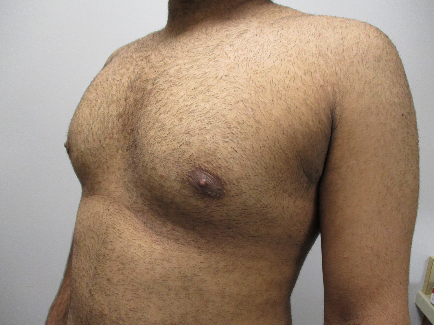 After Image: Patient 21138 - left-front-oblique