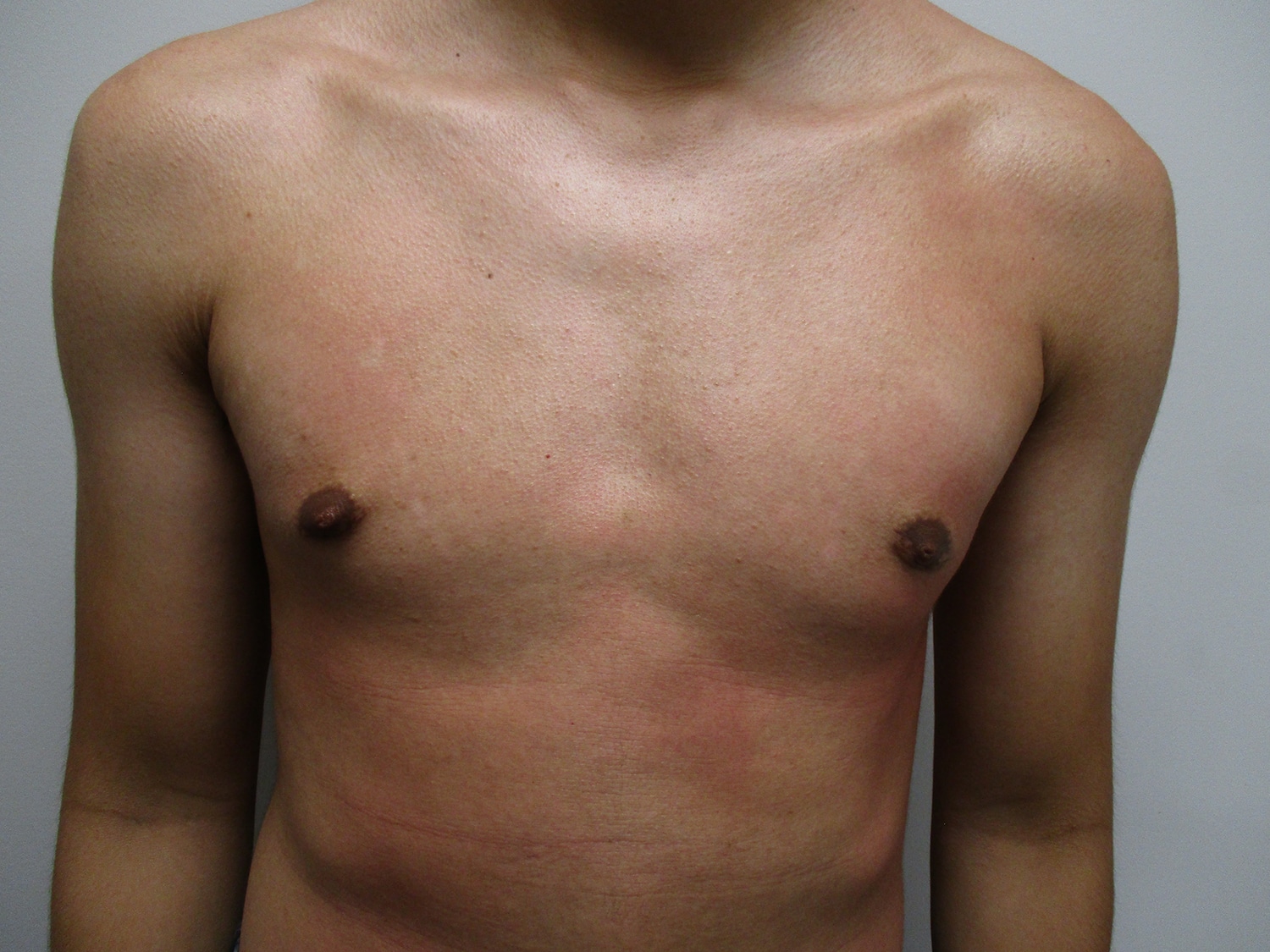 After Image: Patient 21302 - front