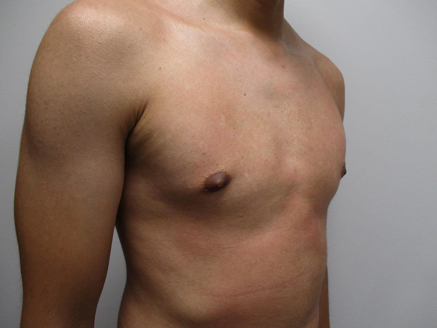 After Image: Patient 21302 - right-front-oblique