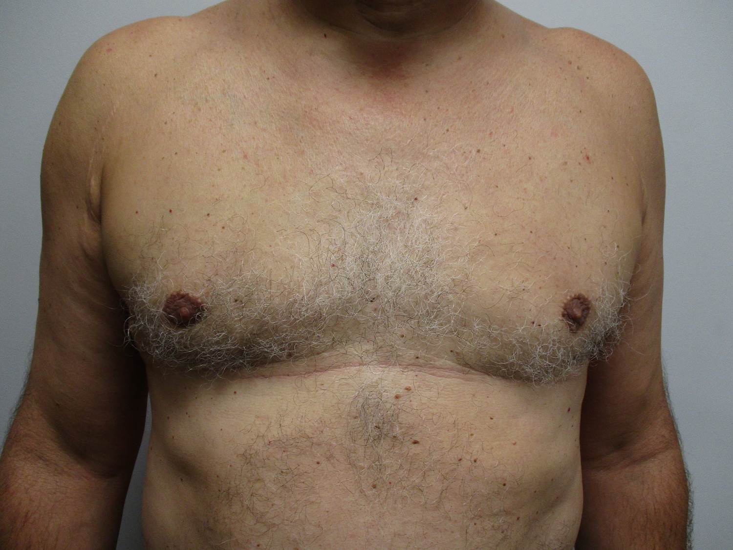 After Image: Patient 21349 - front