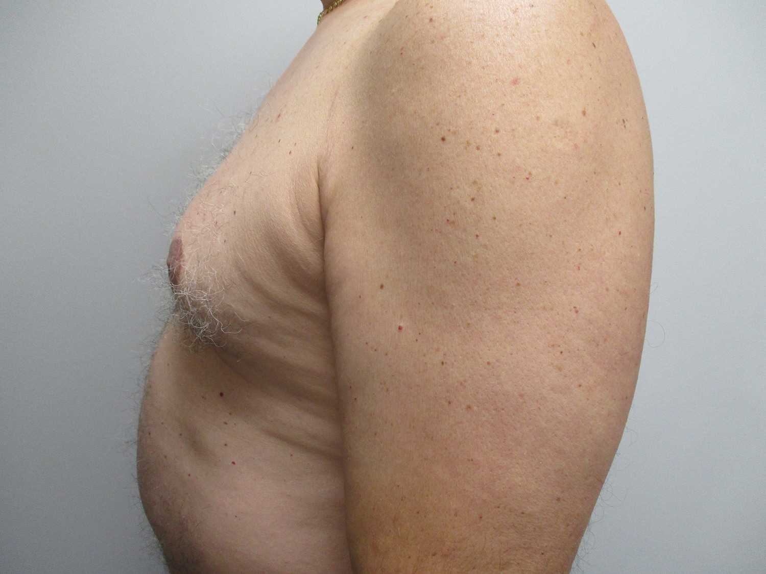Before Image: Patient 21349 - left-side