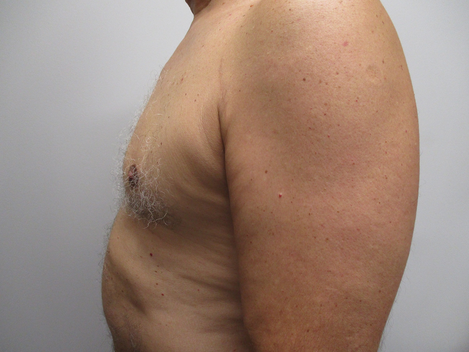 After Image: Patient 21349 - left-side