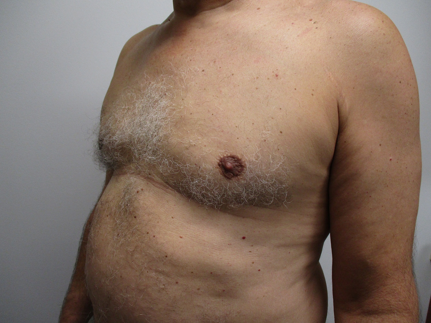 After Image: Patient 21349 - left-front-oblique