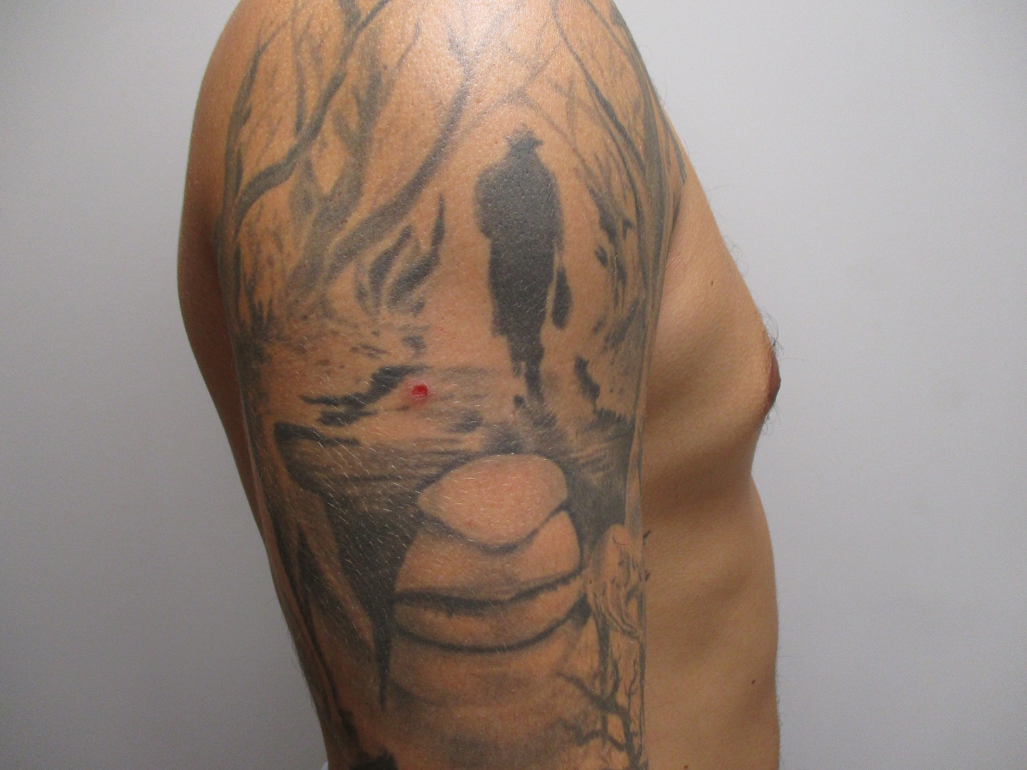 After Image: Patient 21393 - right-side