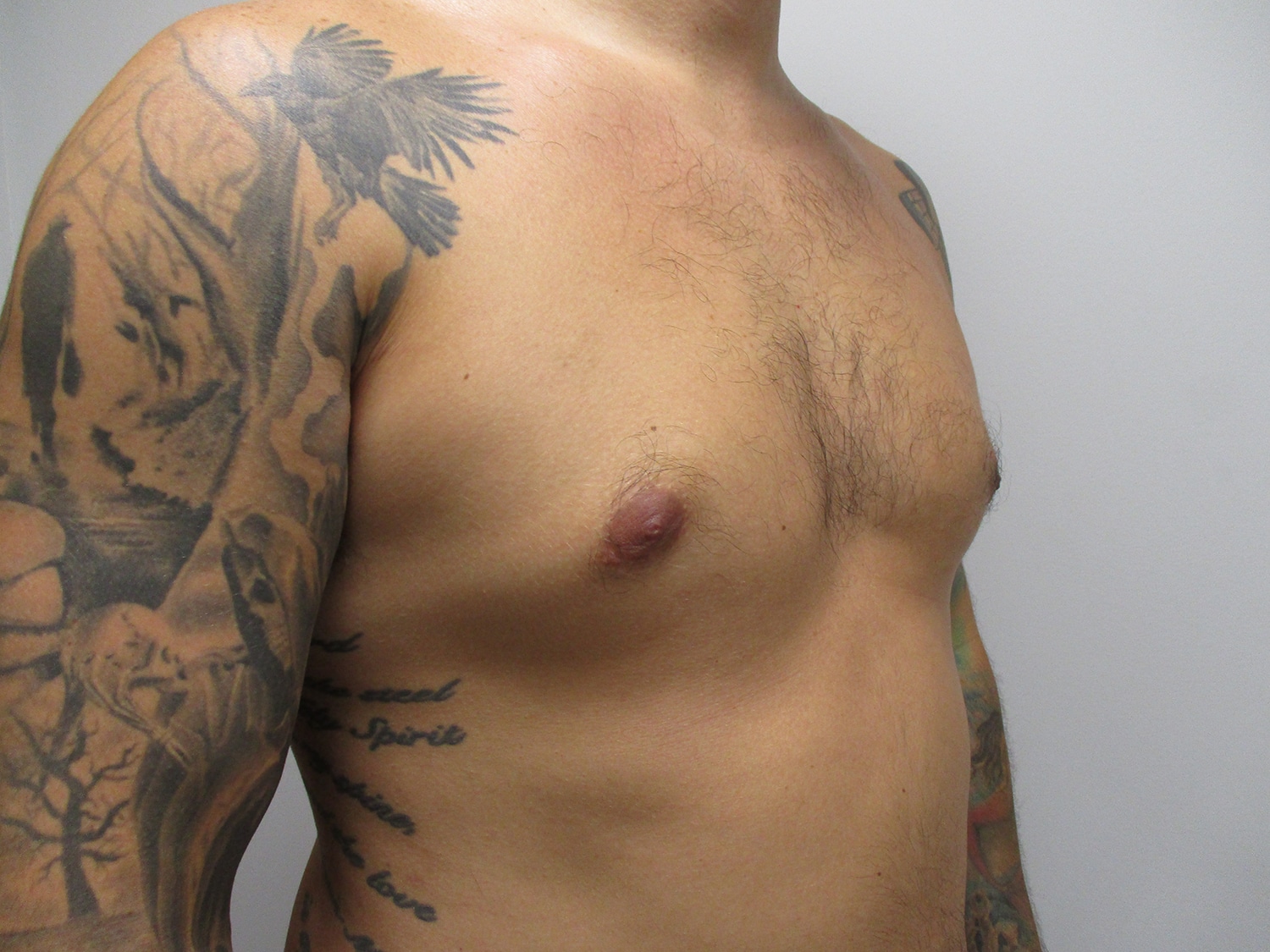 After Image: Patient 21393 - right-front-oblique