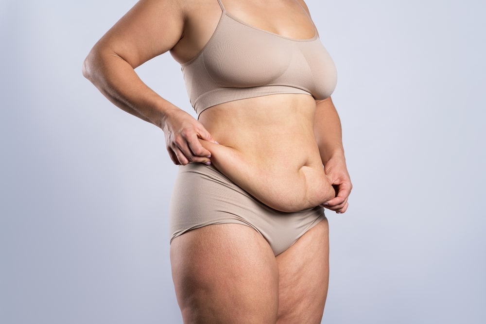 Tummy tuck after weight loss in Long Island and Manhattan