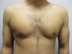 After Image: Patient 21753