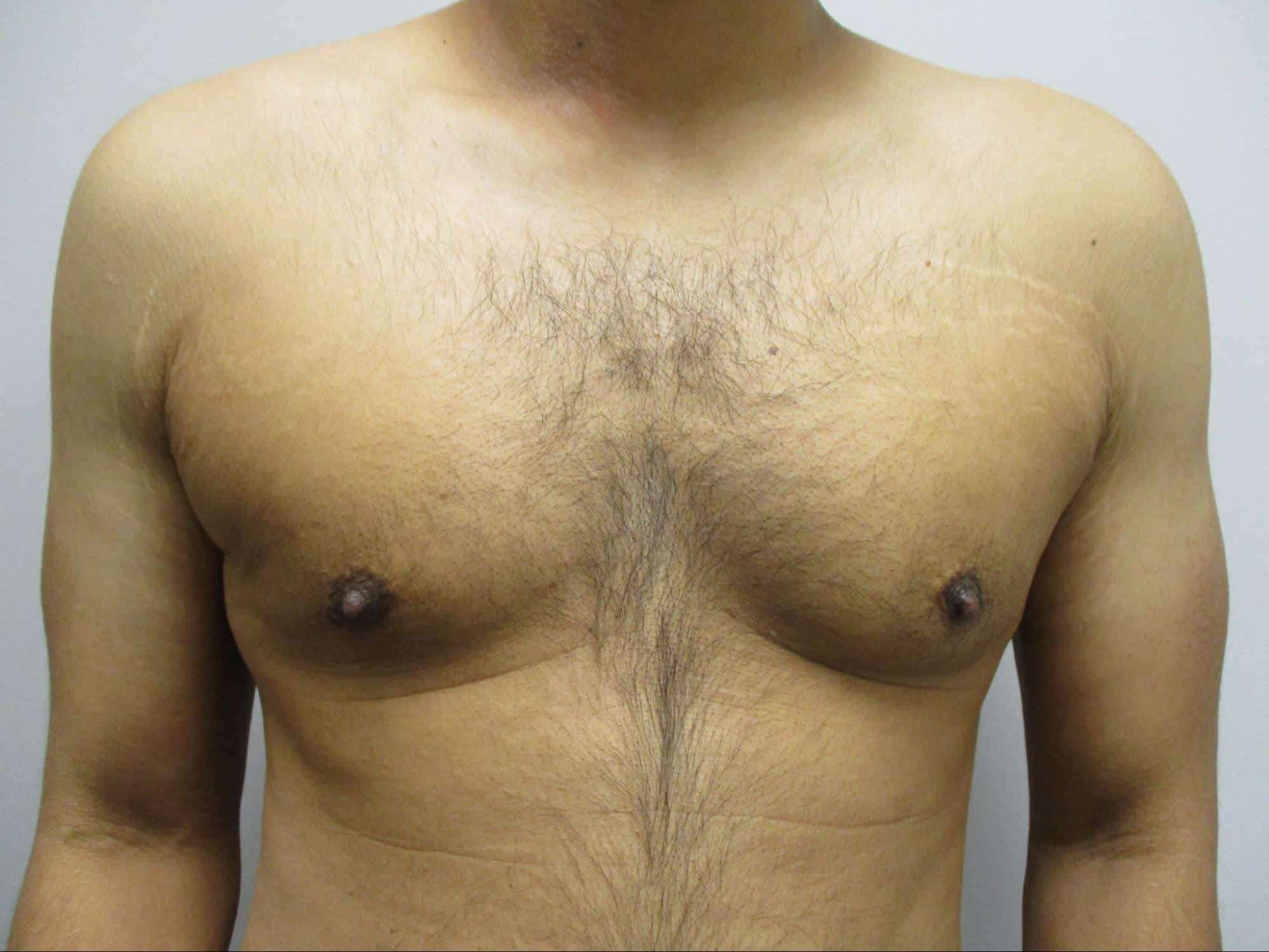 After Image: Patient 21753 - front