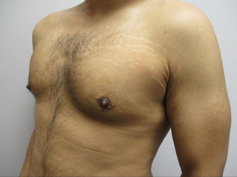 After Image: Patient 21753 - left-front-oblique