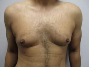 Before Image: Patient 21753