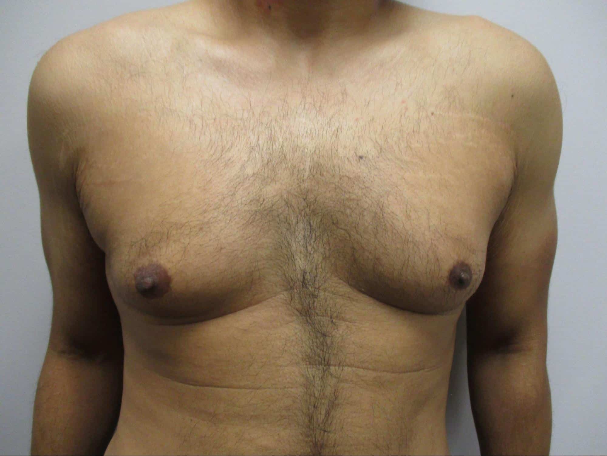 Before Image: Patient 21753 - front