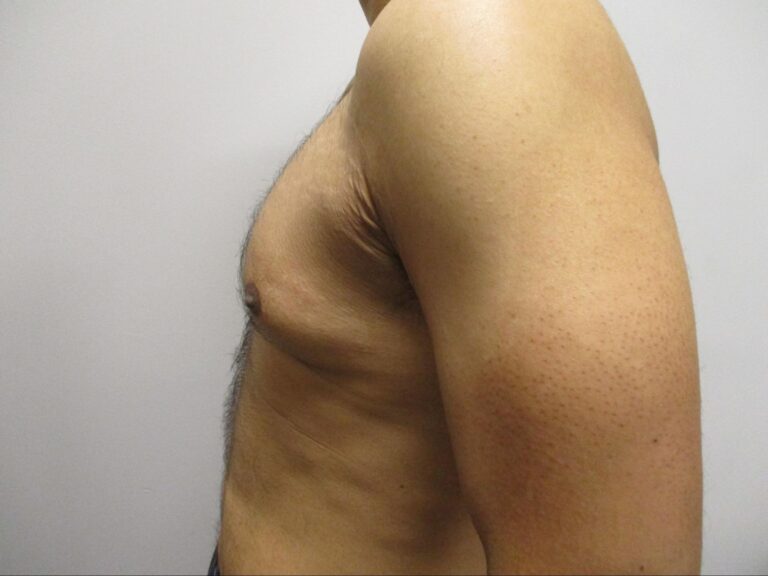 Before Image: Patient 21753 - left-side