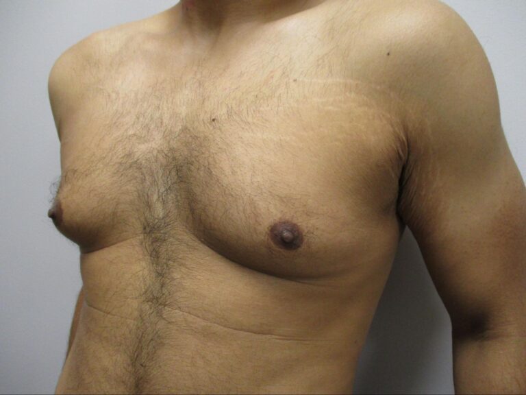 Before Image: Patient 21753 - left-front-oblique