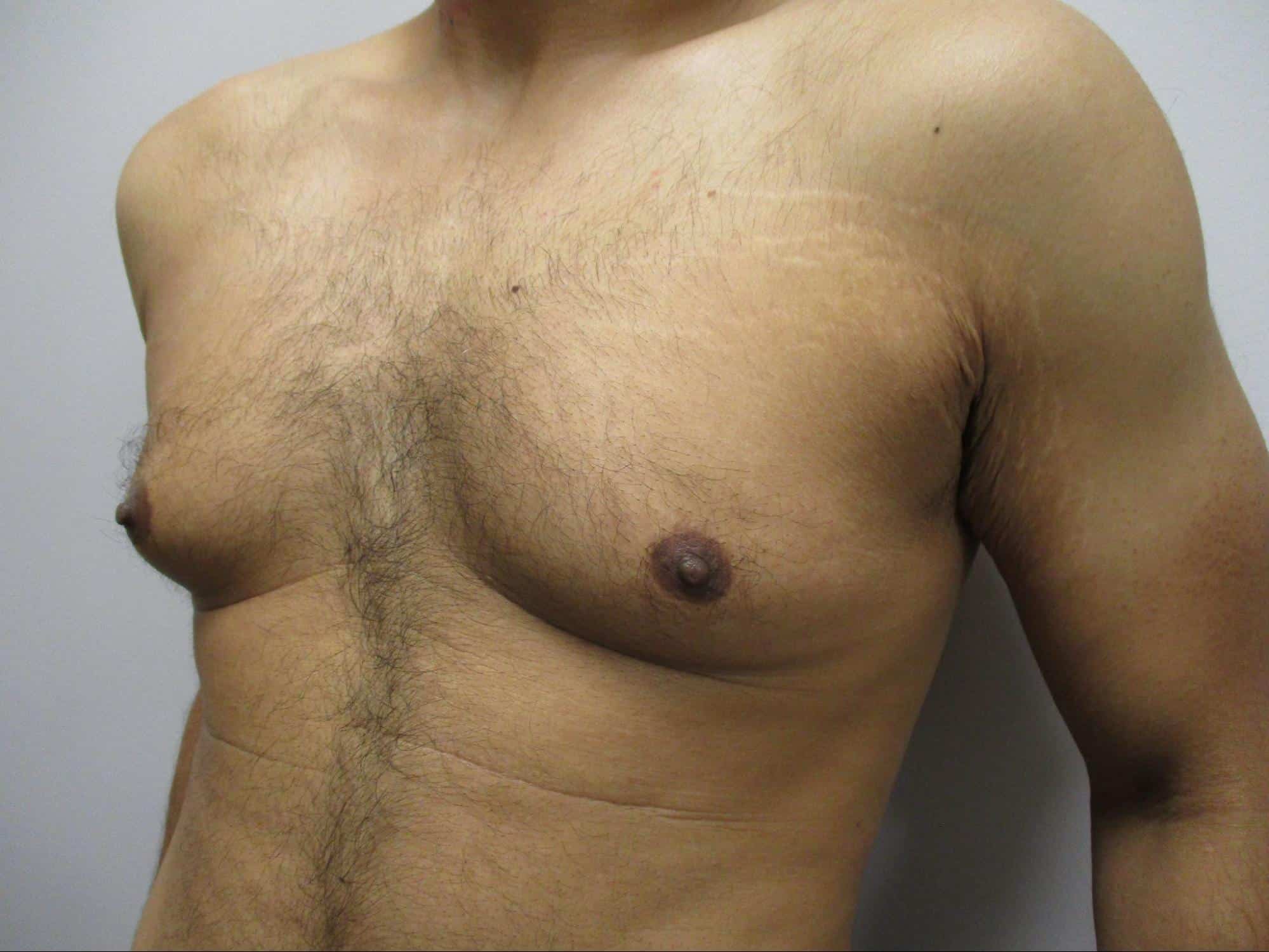 Before Image: Patient 21753 - left-front-oblique