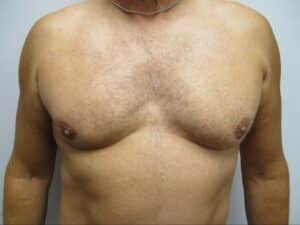 After Image: Patient 21834