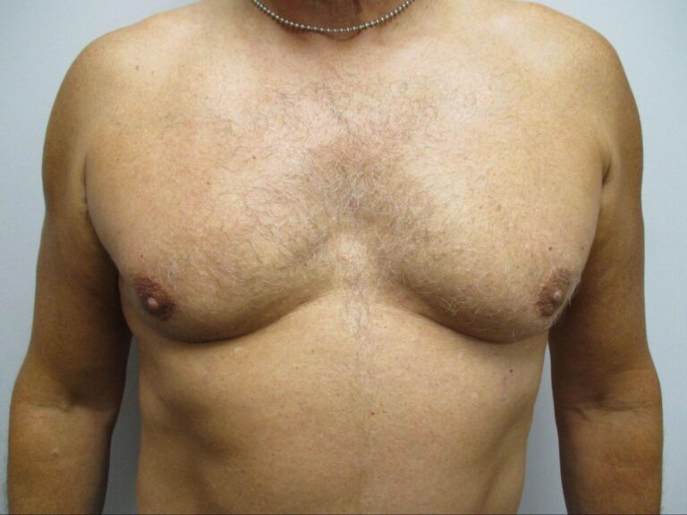 After Image: Patient 21834 - front