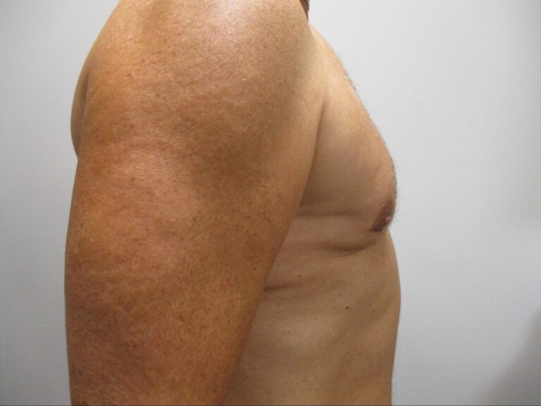 After Image: Patient 21834 - right-side