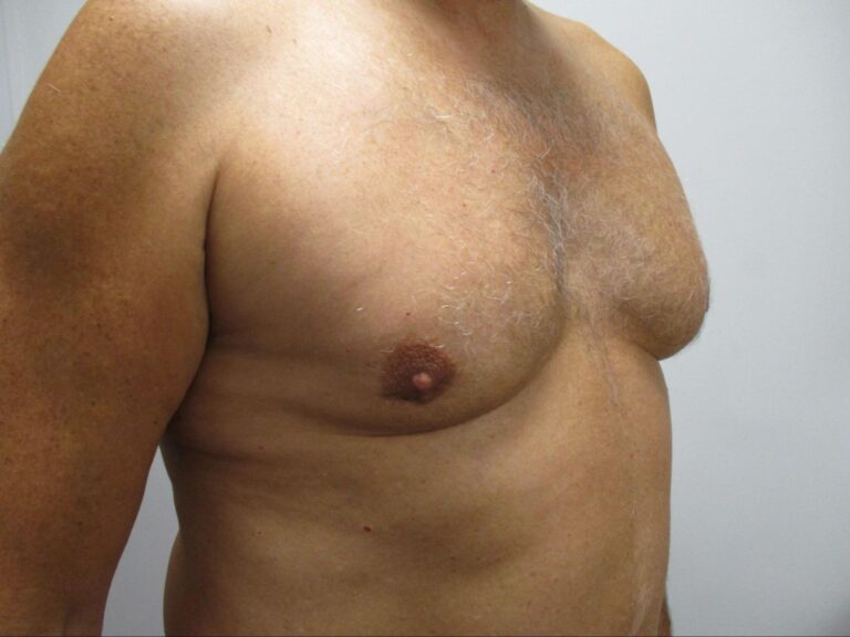 After Image: Patient 21834 - right-front-oblique