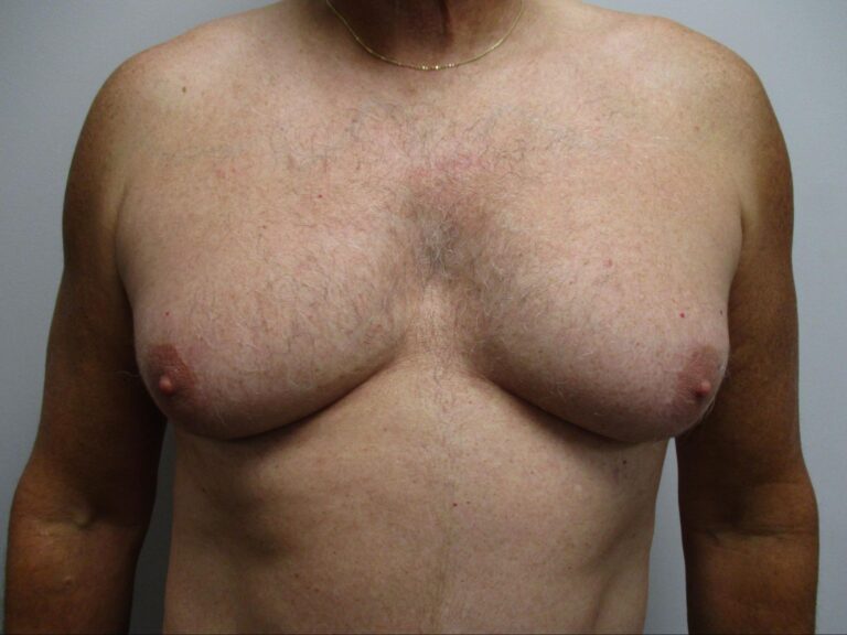 Before Image: Patient 21834 - front