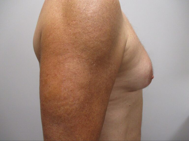 Before Image: Patient 21834 - right-side