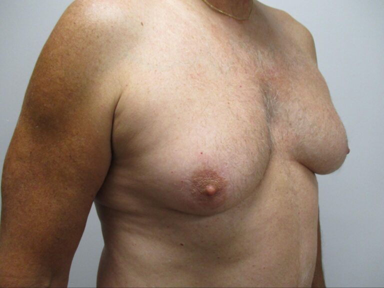 Before Image: Patient 21834 - right-front-oblique
