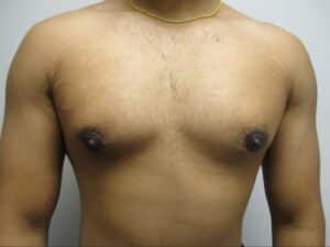 After Image: Patient 21839