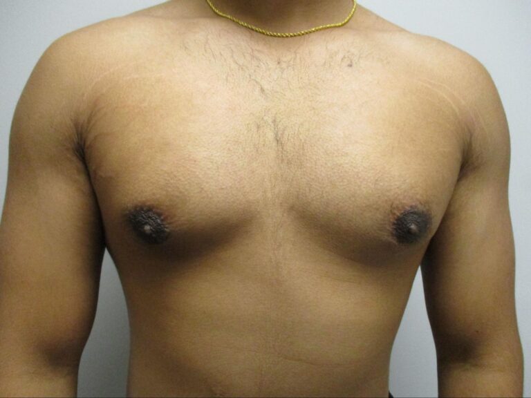 After Image: Patient 21839 - front