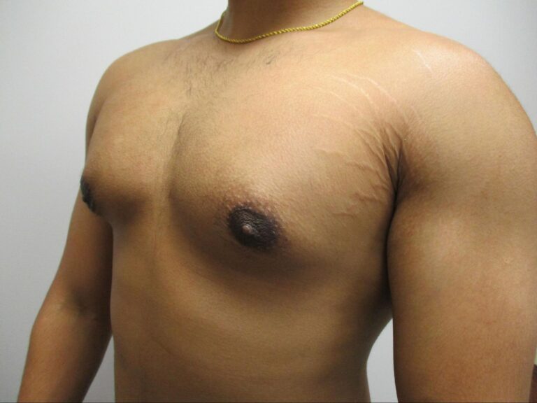 After Image: Patient 21839 - left-front-oblique
