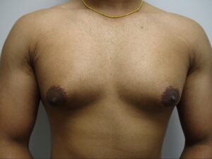 Before Image: Patient 21839