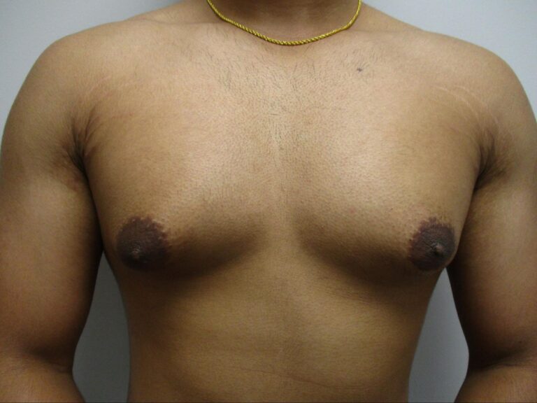 Before Image: Patient 21839 - front