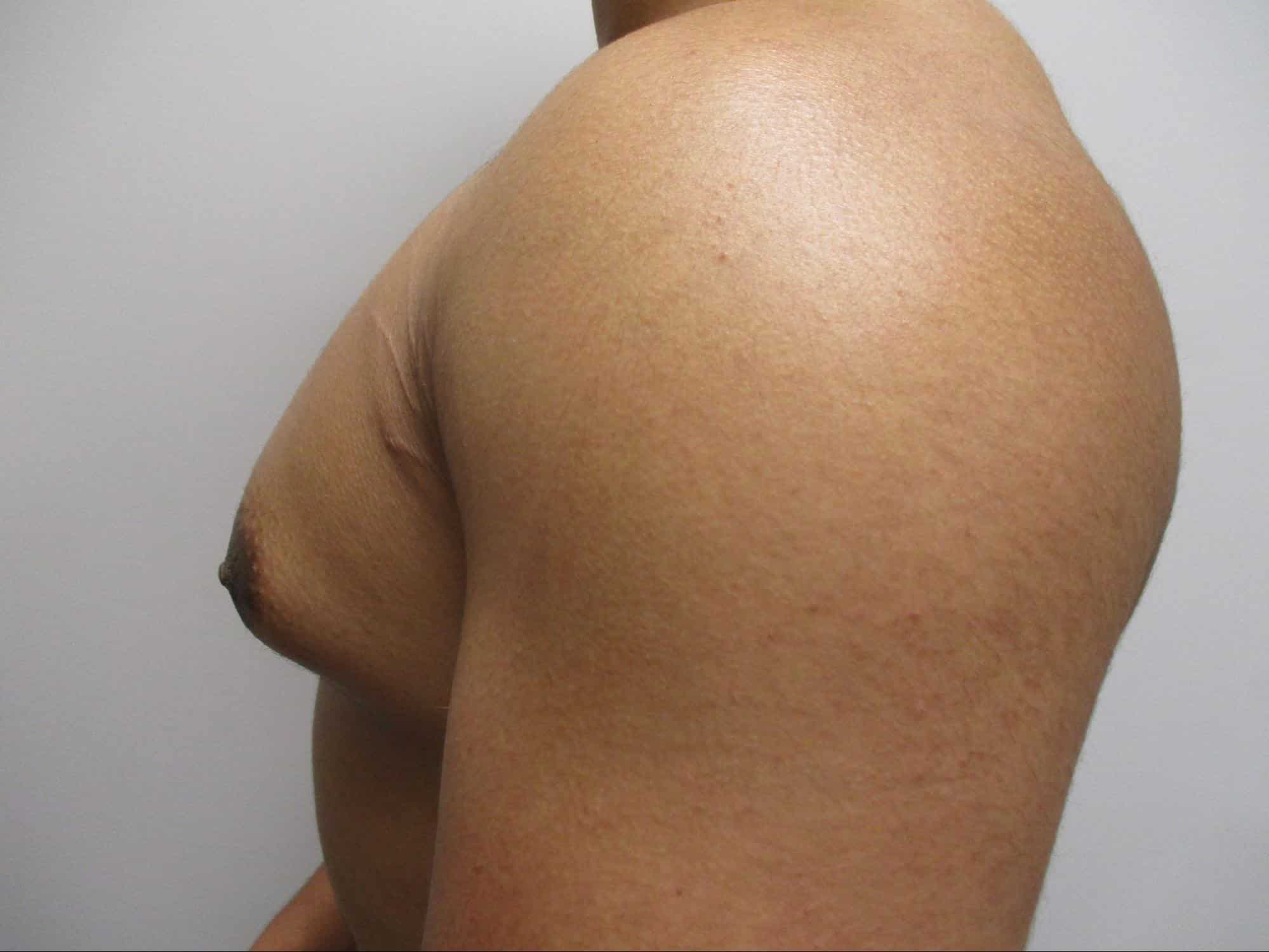 Before Image: Patient 21839 - left-side