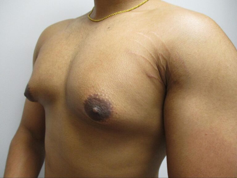 Before Image: Patient 21839 - left-front-oblique