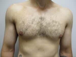 After Image: Patient 22123