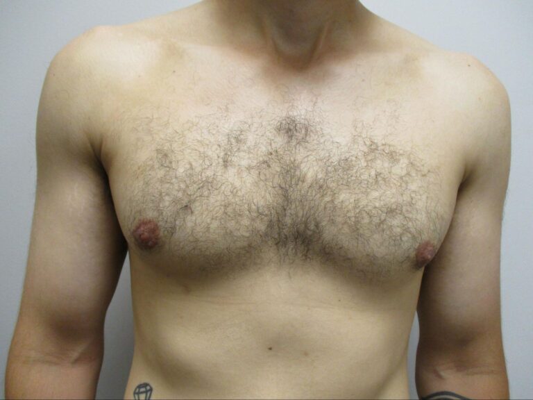 After Image: Patient 22123 - front