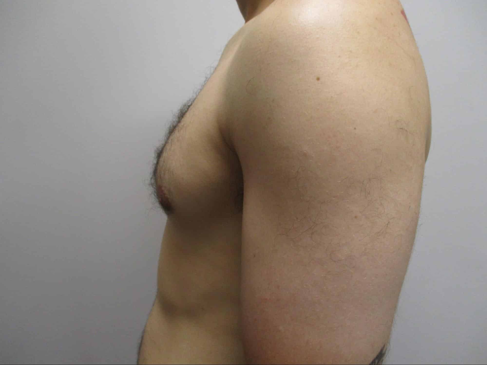 After Image: Patient 22123 - left-side