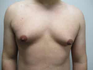 Before Image: Patient 21749