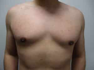 After Image: Patient 21749