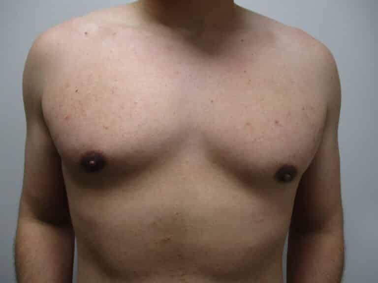 After Image: Patient 21749 - front