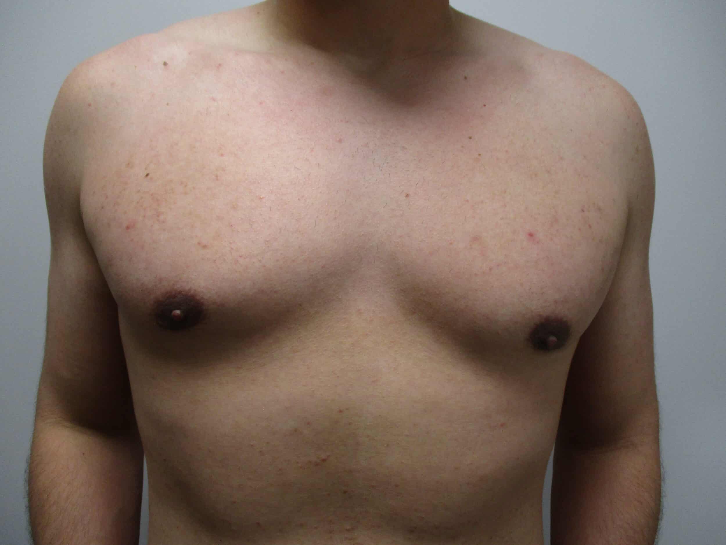 After Image: Patient 21749 - front