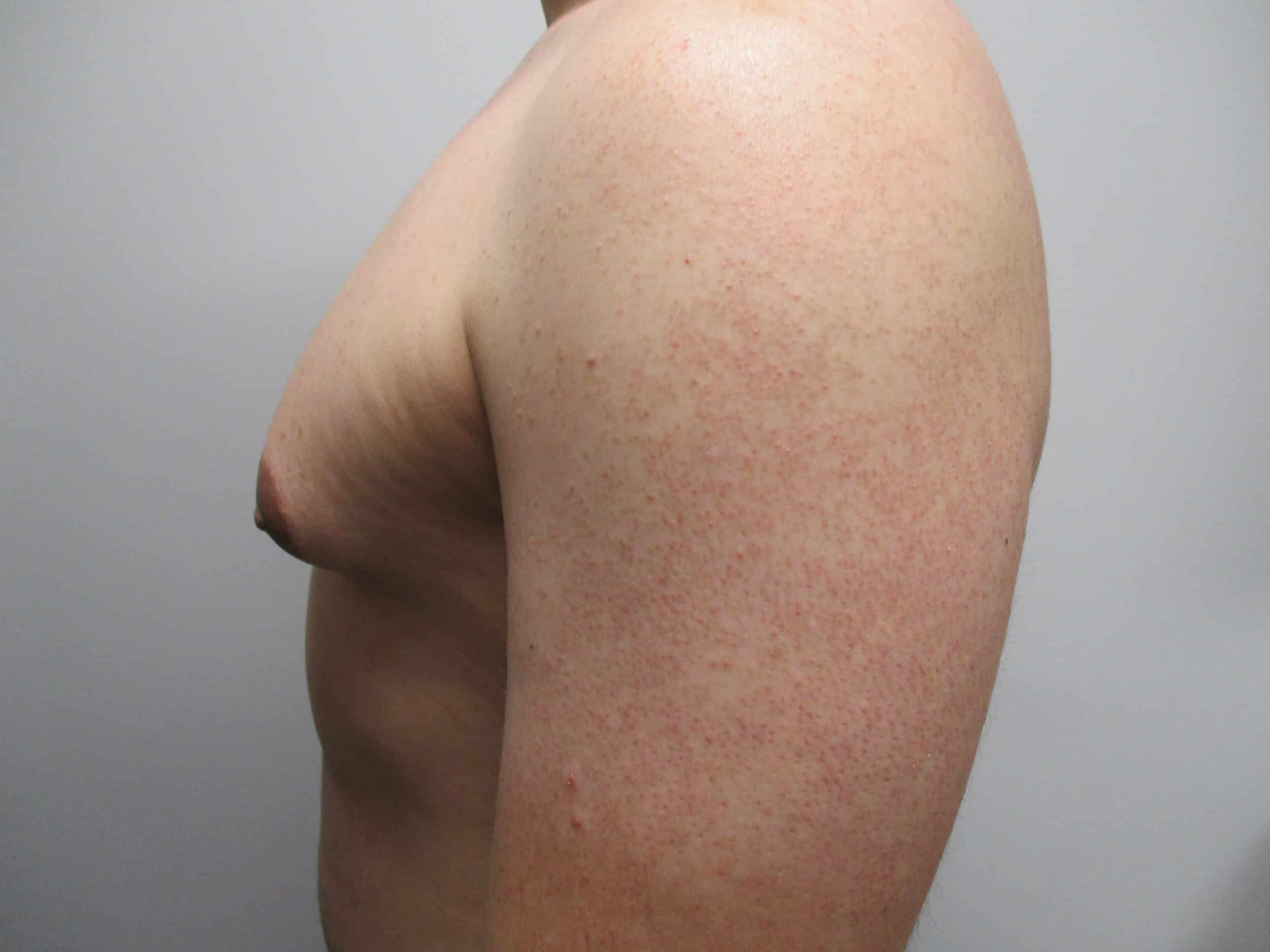Before Image: Patient 21749 - left-side