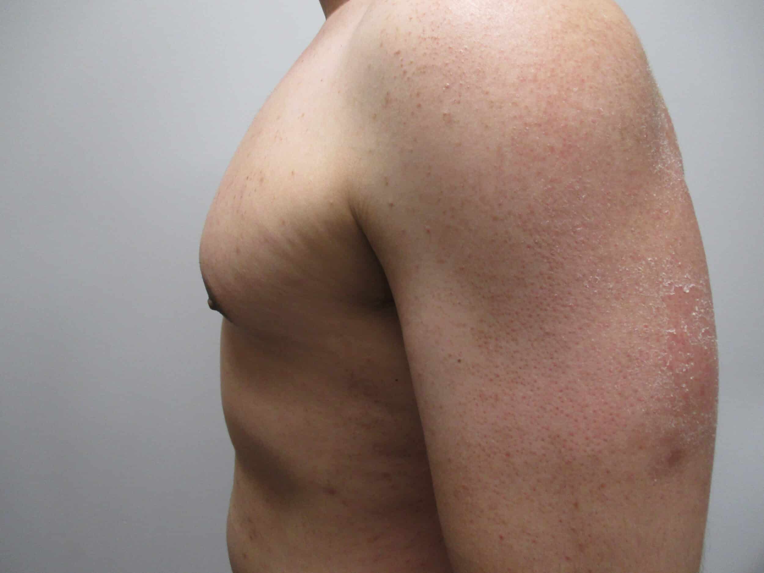 After Image: Patient 21749 - left-side