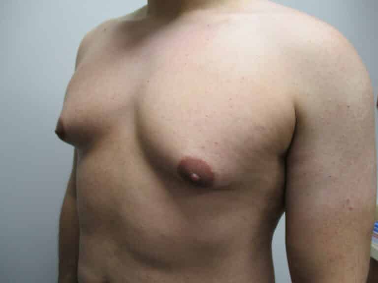 Before Image: Patient 21749 - left-front-oblique