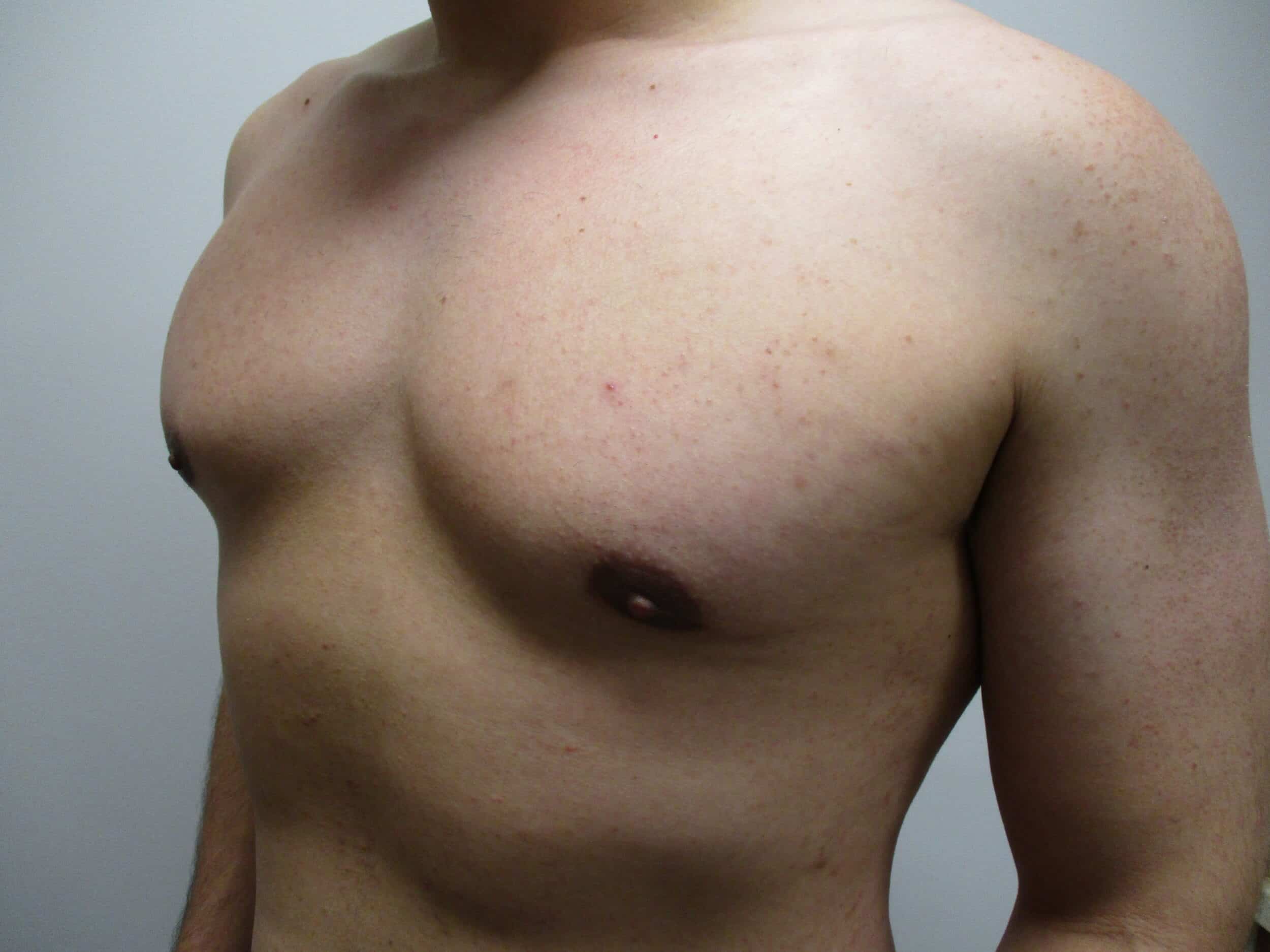 After Image: Patient 21749 - left-front-oblique