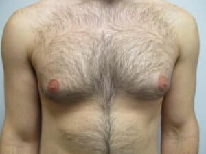 Before Image: Patient 22908